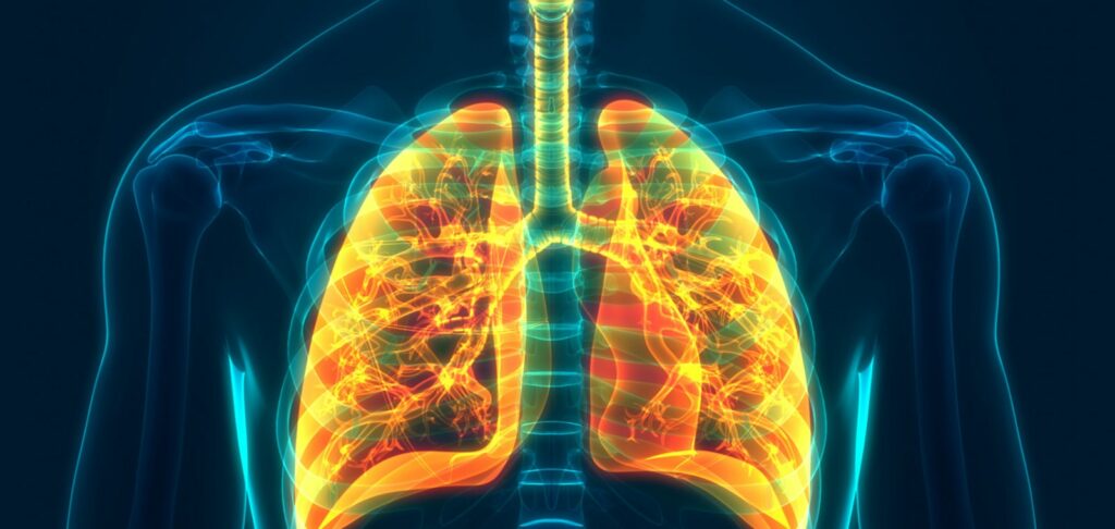 легені, захворювання легень