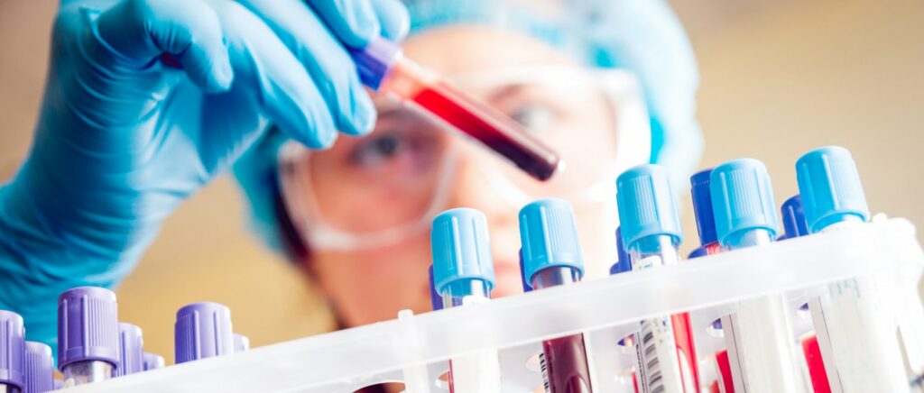 New blood test for Alzheimer’s disease confirmed accurate in clinical trial