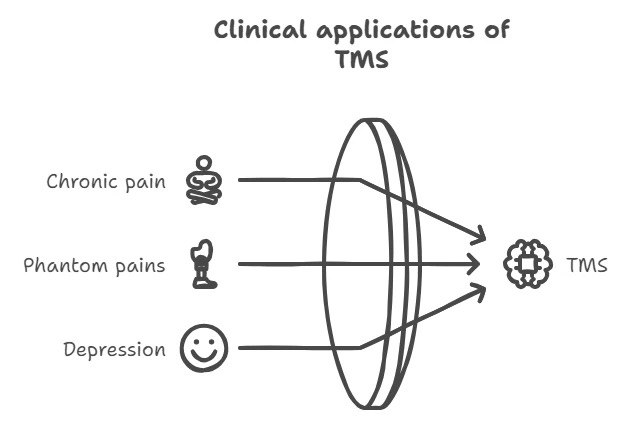 Scheme of clinical application of TMS