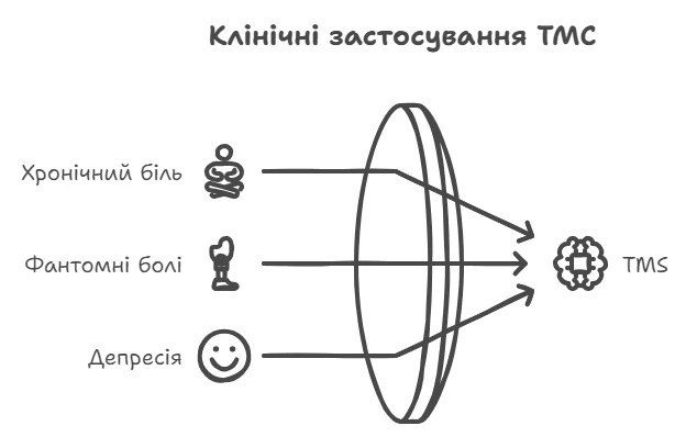 Схема клінічного застосування ТМС