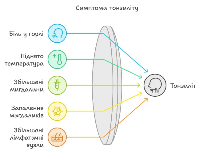 Схема симптомів тонзиліту