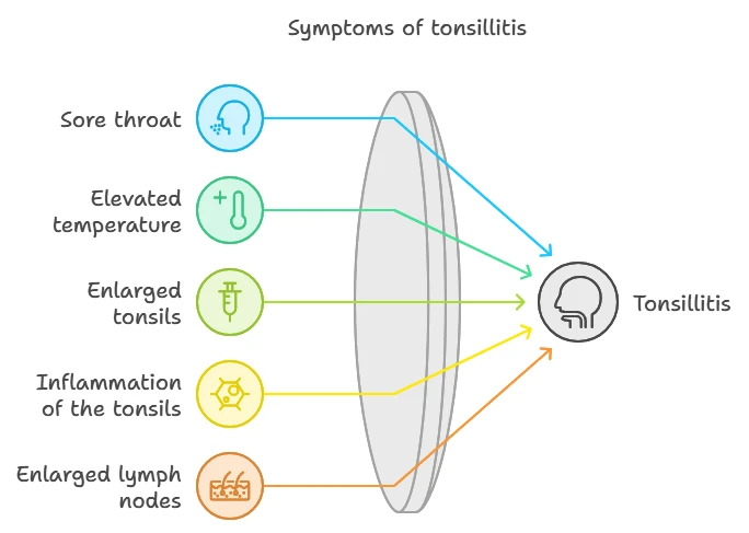 A diagram of the symptoms of tonsillitis