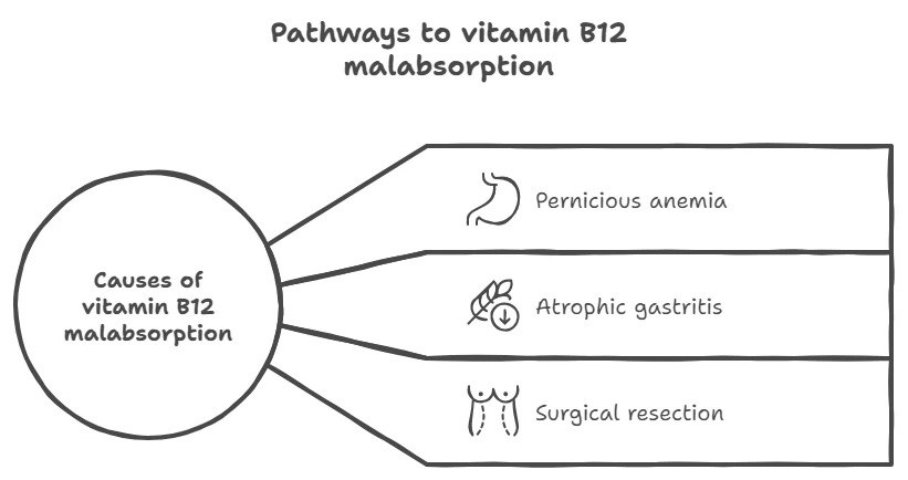 Pathways to Vitamin B12 Malabsorption