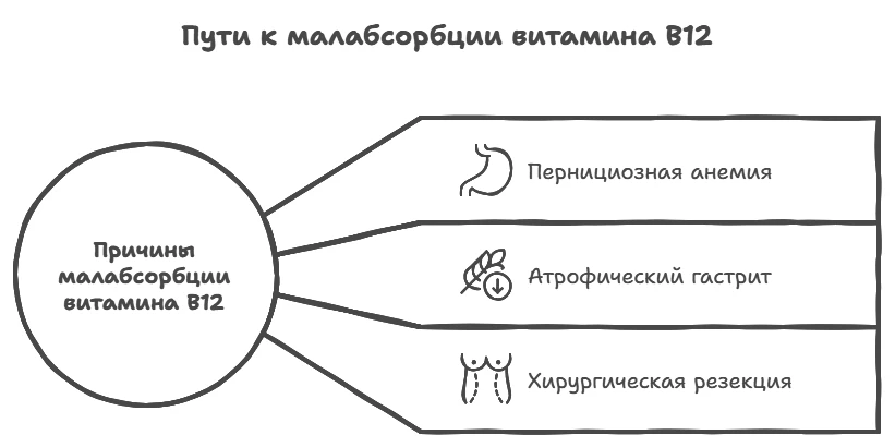 Пути к малабсорбции витамина B12